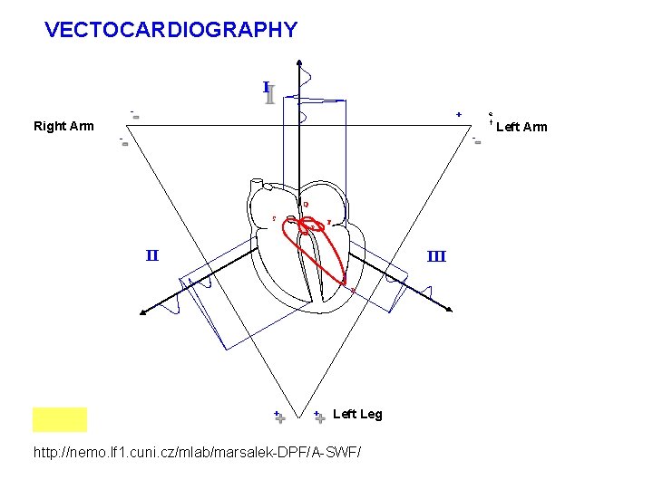 VECTOCARDIOGRAPHY I - Right Arm + e f - - Q Q S T