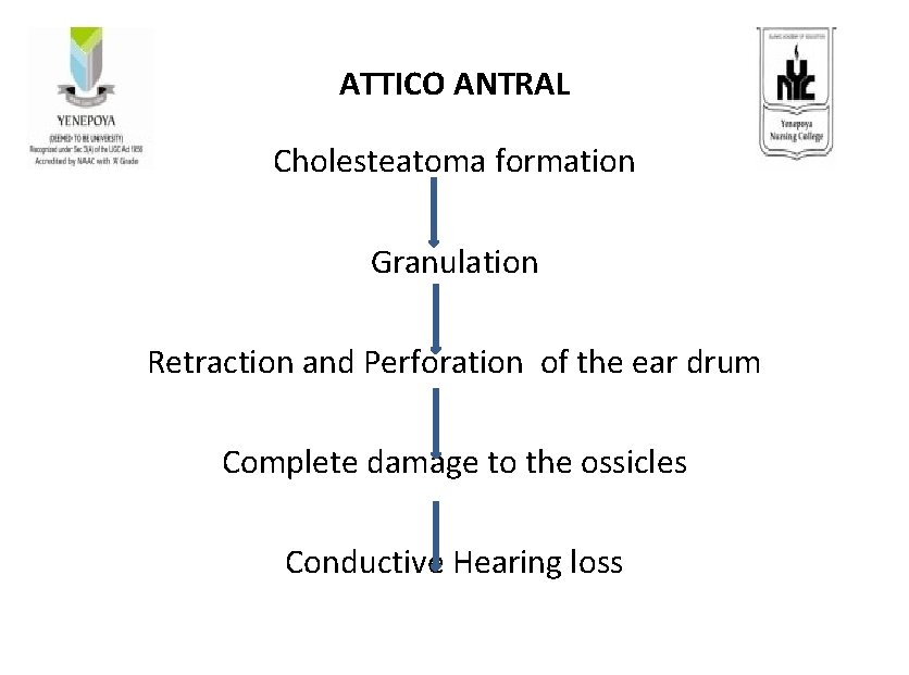 ATTICO ANTRAL Cholesteatoma formation Granulation Retraction and Perforation of the ear drum Complete damage