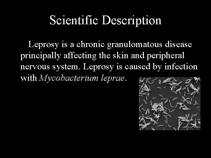 Scientific Description Leprosy is a chronic granulomatous disease principally affecting the skin and peripheral