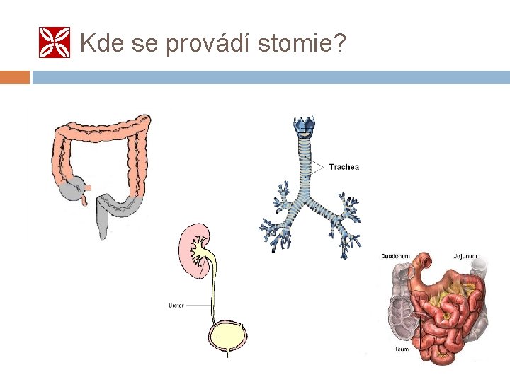  Kde se provádí stomie? 