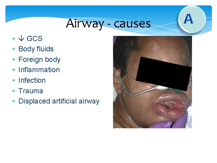Airway - causes GCS Body fluids Foreign body Inflammation Infection Trauma Displaced artificial airway Airway - causes GCS Body fluids Foreign body Inflammation Infection Trauma Displaced artificial airway