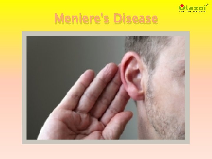 Meniere's Disease 