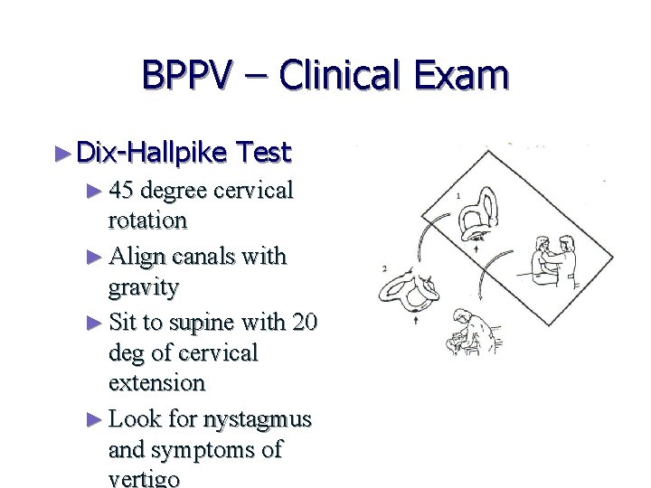 BPPV – Clinical Exam ► Dix-Hallpike Test ► 45 degree cervical rotation ► Align