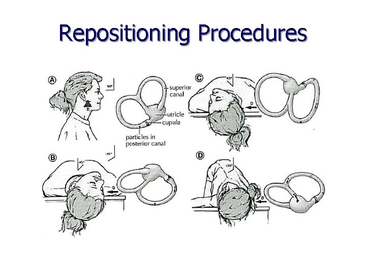 Repositioning Procedures Parnes, 2003 