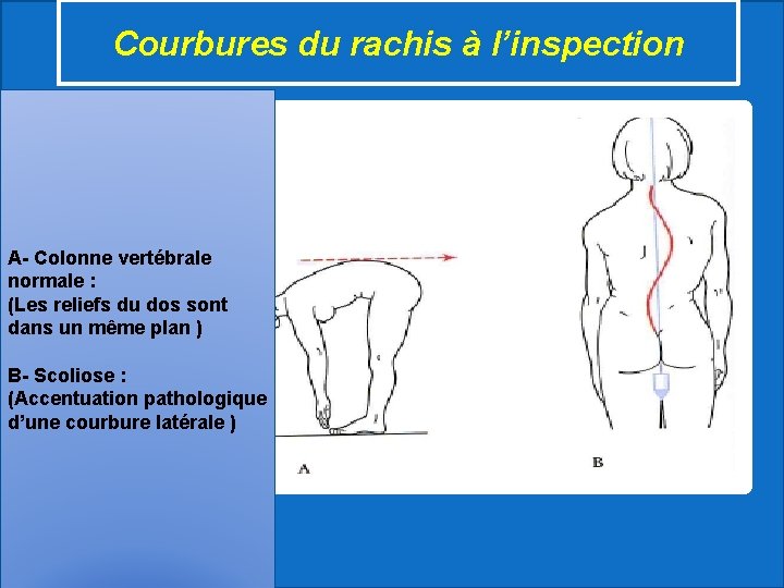 Courbures du rachis à l’inspection A- Colonne vertébrale normale : (Les reliefs du dos