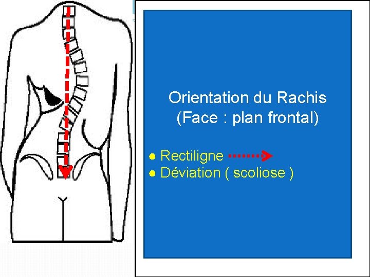 Orientation du Rachis (Face : plan frontal) ● Rectiligne ● Déviation ( scoliose )