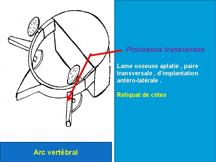 Processus transverses Lame osseuse aplatie , paire transversale , d’implantation antéro-latérale. Reliquat de côtes