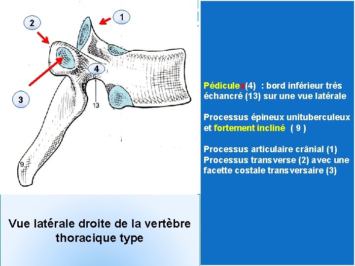 1 2 4 3 Pédicules(4) : bord inférieur très échancré (13) sur une vue