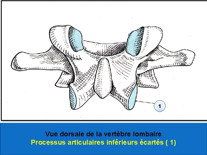 1 Vue dorsale de la vertèbre lombaire Processus articulaires inférieurs écartés ( 1) 