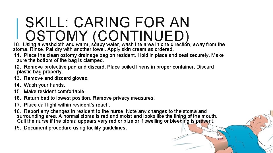 SKILL: CARING FOR AN OSTOMY (CONTINUED) 10. Using a washcloth and warm, soapy water,