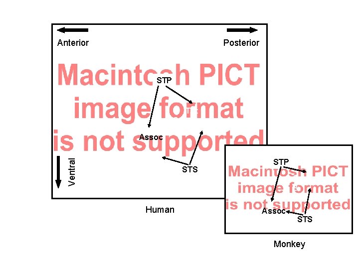 Anterior Posterior STP Tpt HG PT Ventral Assoc STS Human STP C B PB