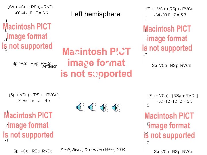 (Sp + VCo + RSp) - RVCo -60 -4 -10 Z = 6. 6