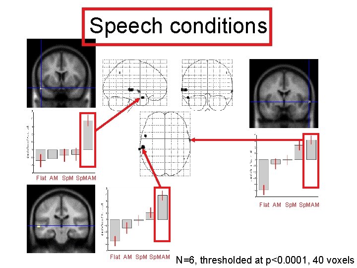 Speech conditions Flat AM Sp. MAM N=6, thresholded at p<0. 0001, 40 voxels 