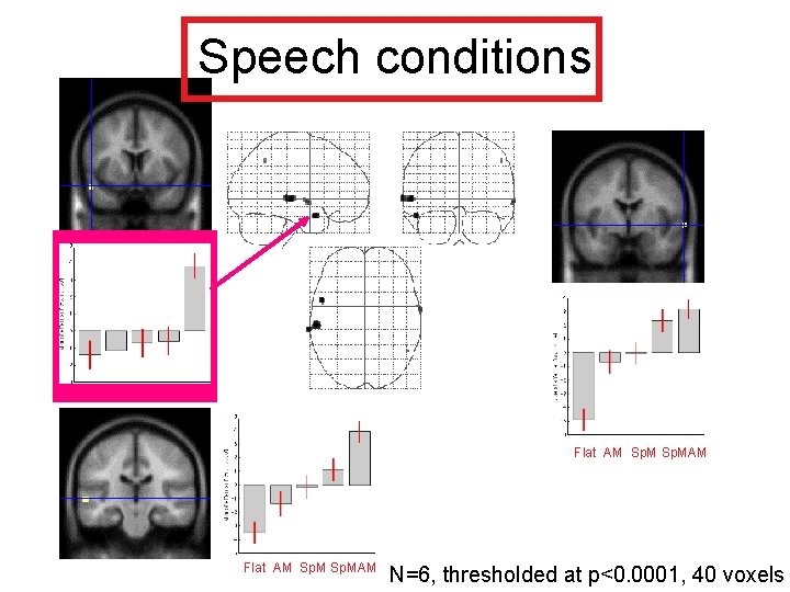 Speech conditions Flat AM Sp. MAM N=6, thresholded at p<0. 0001, 40 voxels 