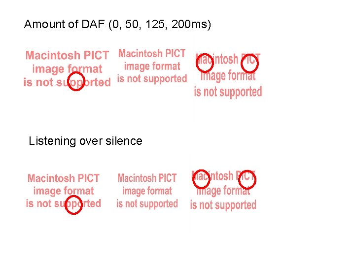 Amount of DAF (0, 50, 125, 200 ms) Listening over silence 