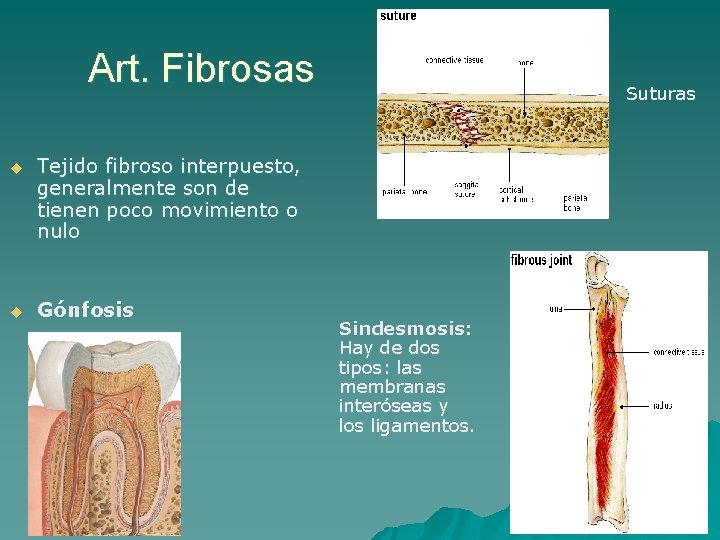 Art. Fibrosas u Tejido fibroso interpuesto, generalmente son de tienen poco movimiento o nulo