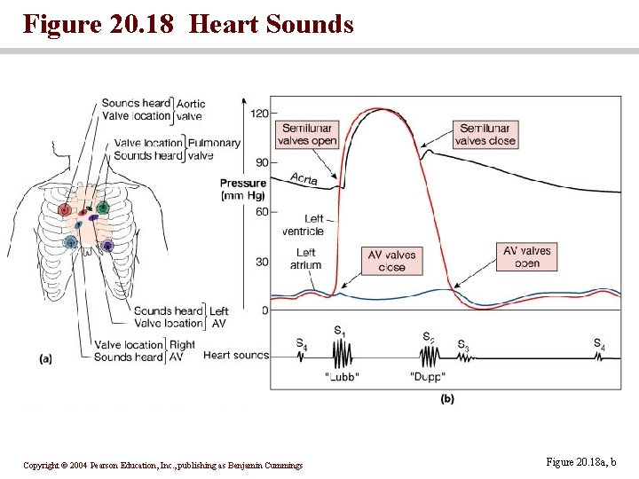 Figure 20. 18 Heart Sounds Copyright © 2004 Pearson Education, Inc. , publishing as