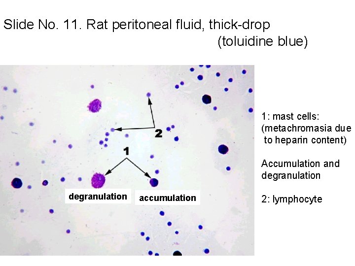 Slide No. 11. Rat peritoneal fluid, thick-drop (toluidine blue) 1: mast cells: (metachromasia due