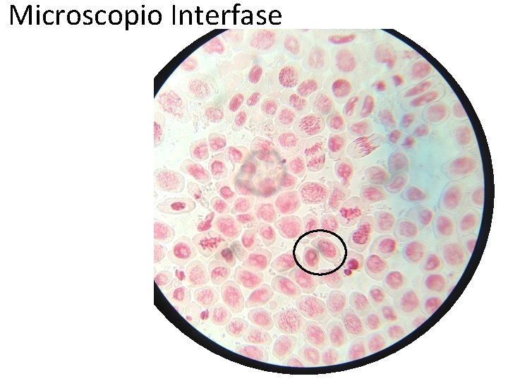 Microscopio Interfase 