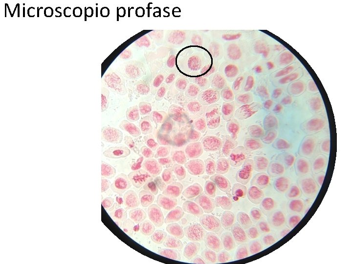 Microscopio profase 