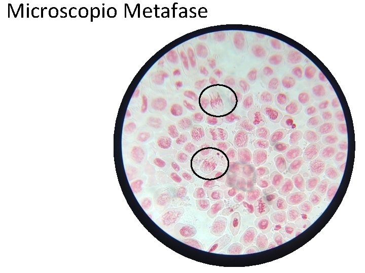Microscopio Metafase 