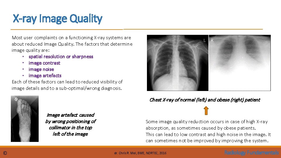 X-ray Image Quality Most user complaints on a functioning X-ray systems are about reduced