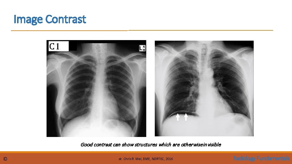 Image Contrast Good contrast can show structures which are otherwise invisible © dr. Chris