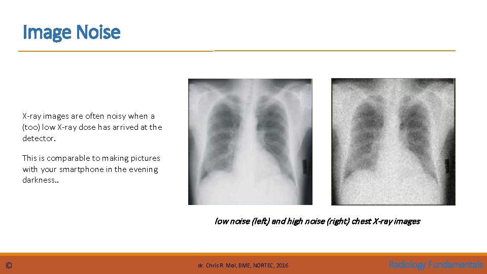 Image Noise X-ray images are often noisy when a (too) low X-ray dose has