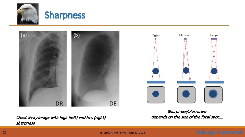 Sharpness Chest X-ray image with high (left) and low (right) sharpness © dr. Chris