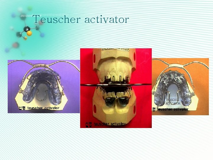 Teuscher activator 