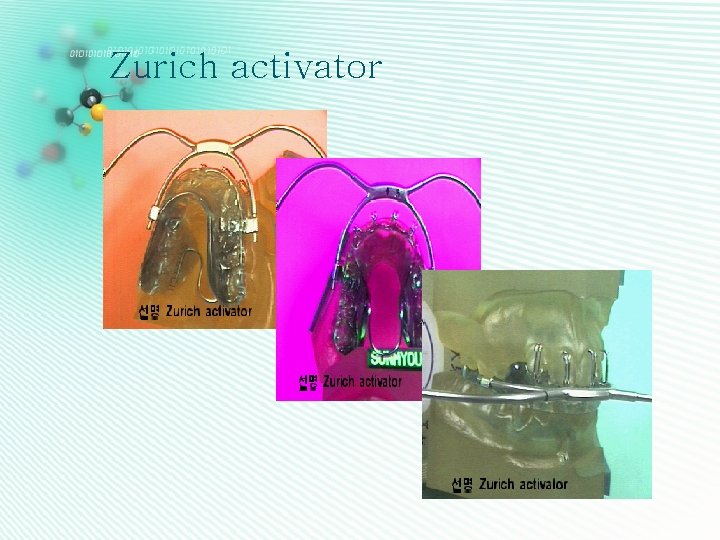 Zurich activator 