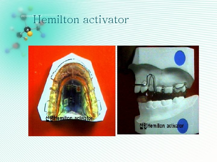 Hemilton activator 