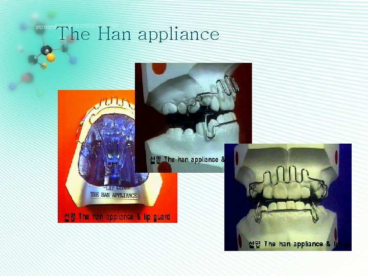 The Han appliance 