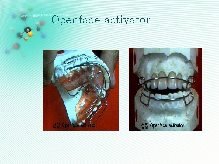 Openface activator 