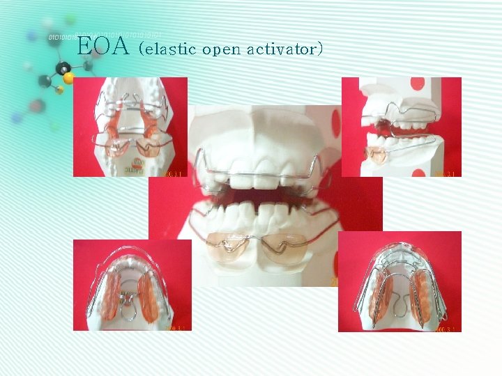 EOA (elastic open activator) 
