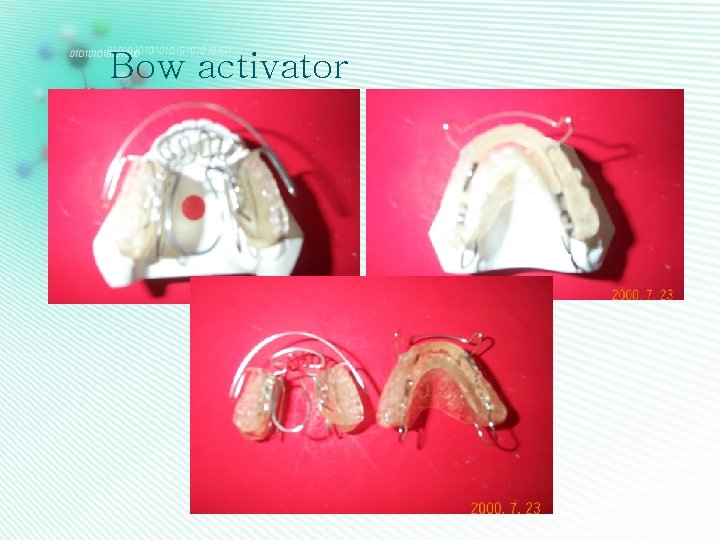 Bow activator 
