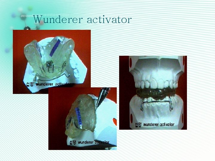 Wunderer activator 
