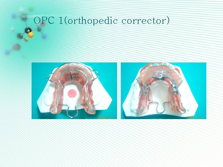 OPC 1(orthopedic corrector) 