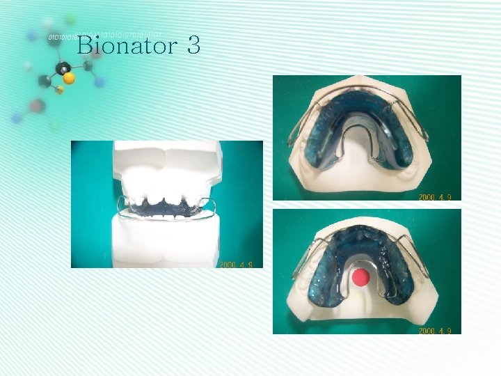 Bionator 3 