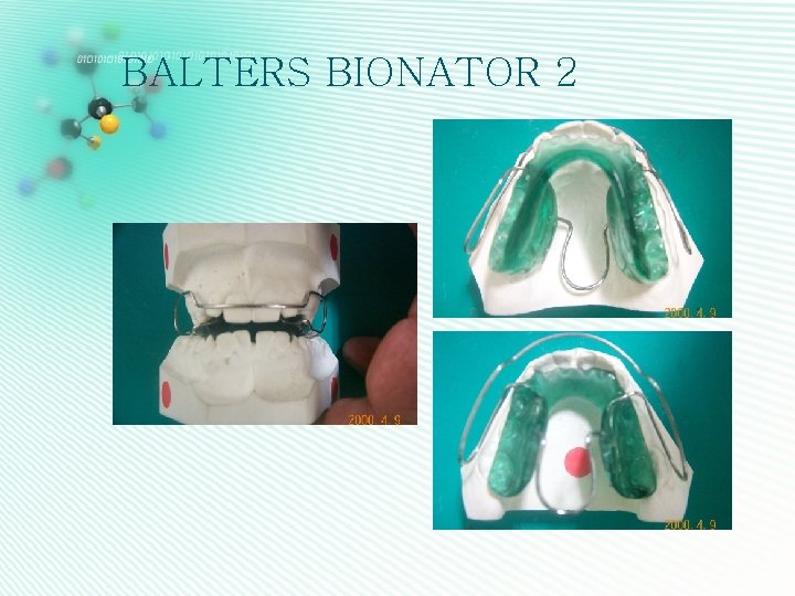 BALTERS BIONATOR 2 