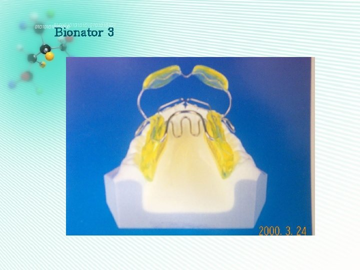 Bionator 3 