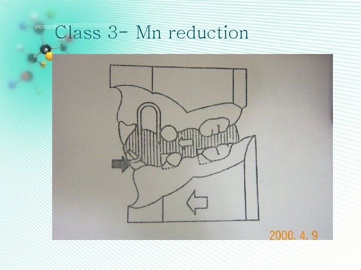 Class 3 - Mn reduction 