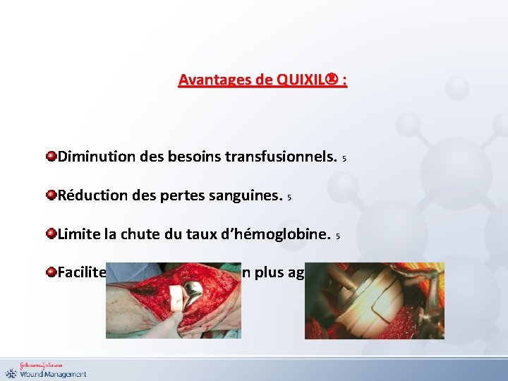 Avantages de QUIXIL : Diminution des besoins transfusionnels. 5 Réduction des pertes sanguines. 5