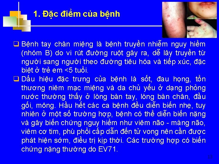 1. Đặc điểm của bệnh q Bệnh tay chân miệng là bệnh truyền nhiễm