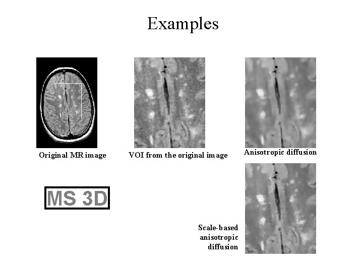 Examples Original MR image VOI from the original image MS 3 D Scale-based anisotropic