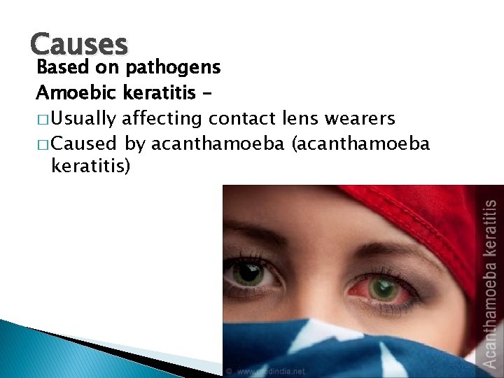 Causes Based on pathogens Amoebic keratitis – � Usually affecting contact lens wearers �