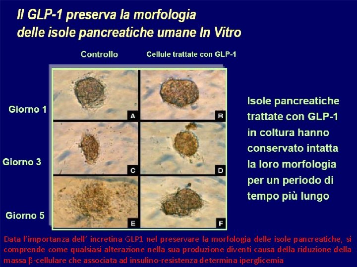 Data l’importanza dell’ incretina GLP 1 nel preservare la morfologia delle isole pancreatiche, si