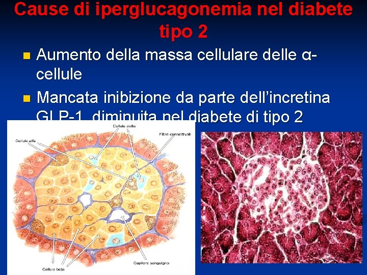 Cause di iperglucagonemia nel diabete tipo 2 Aumento della massa cellulare delle αcellule n