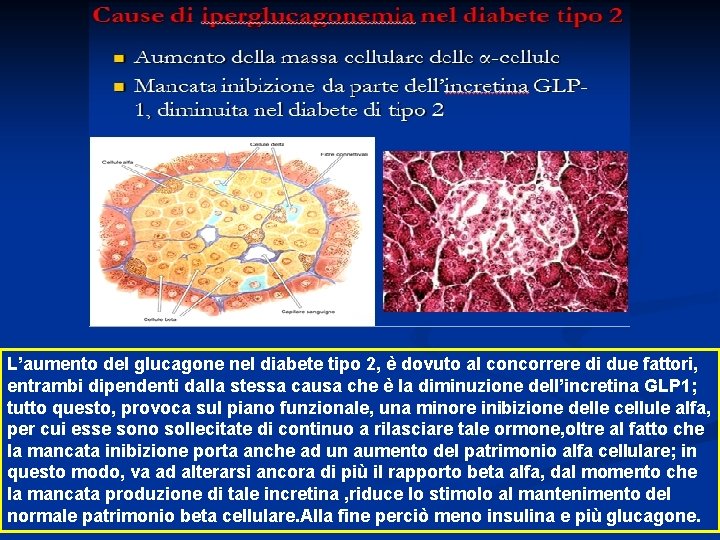 L’aumento del glucagone nel diabete tipo 2, è dovuto al concorrere di due fattori,