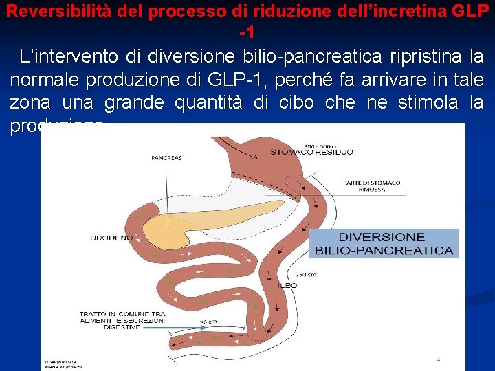 Reversibilità del processo di riduzione dell’incretina GLP -1 L’intervento di diversione bilio-pancreatica ripristina la